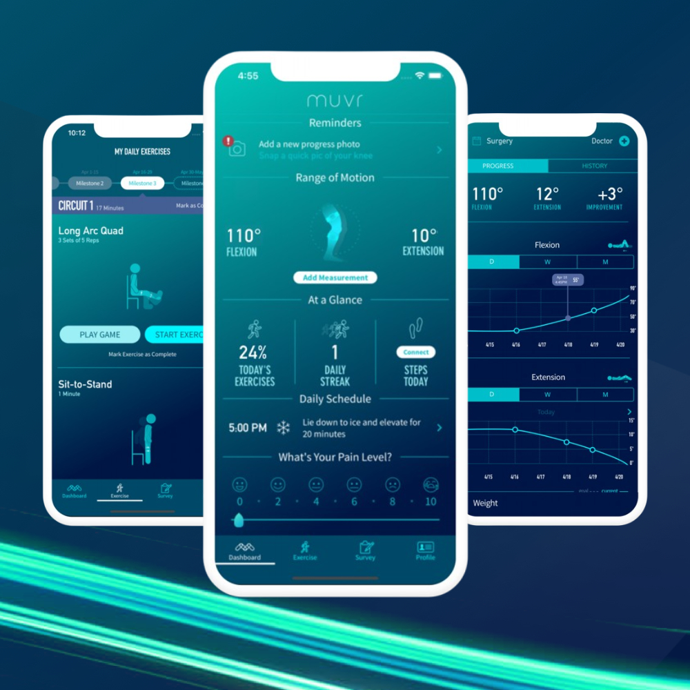 Muvr –  Simplifies diagnostics and big data for orthopedic practices